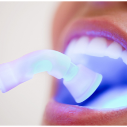 Estética dental 
